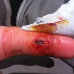 dane's finger